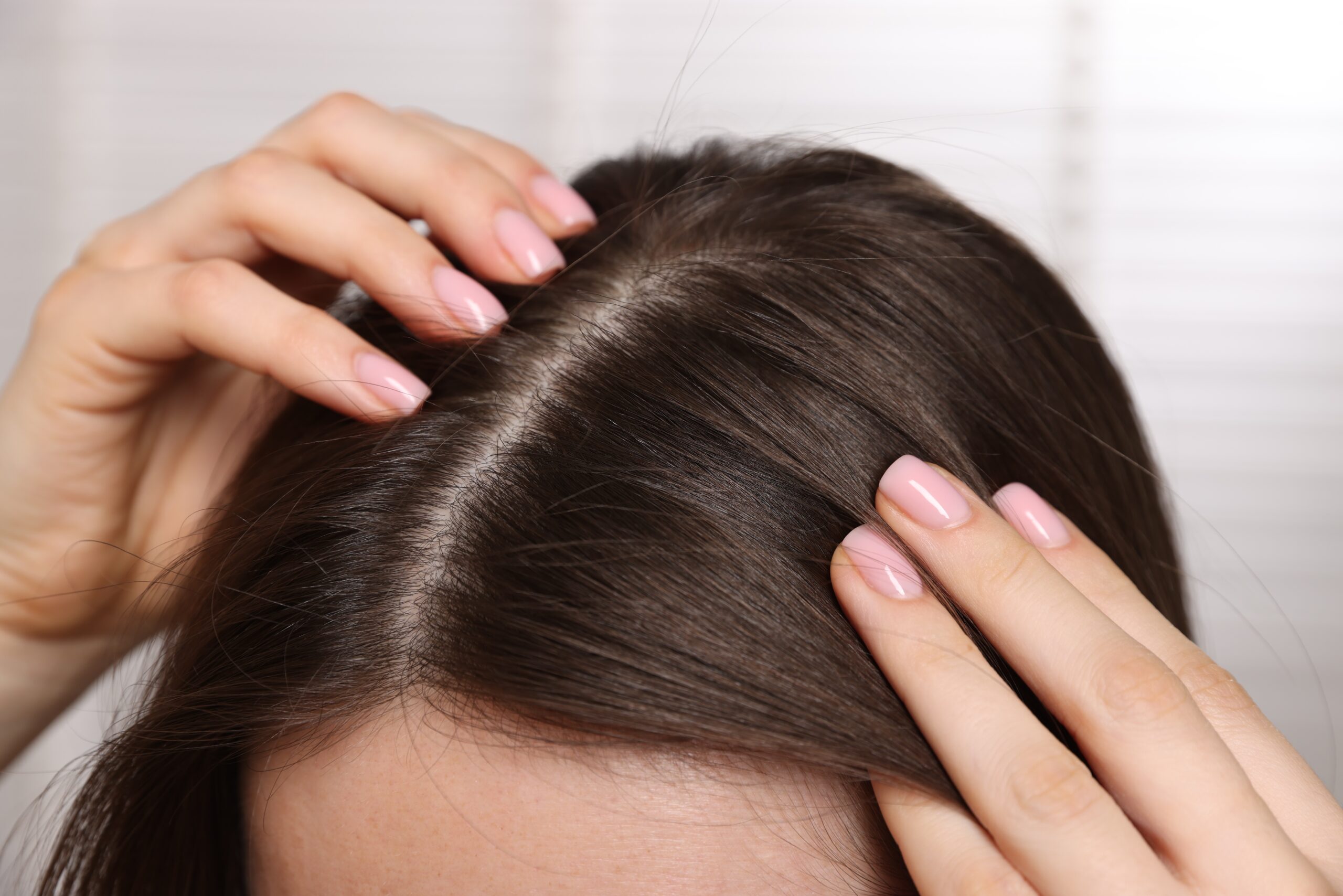 hair loss dermatologist near Camillus