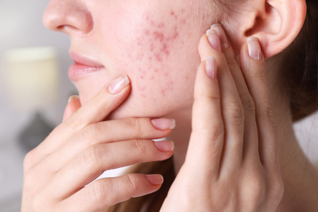 dermatologist near liverpool ny